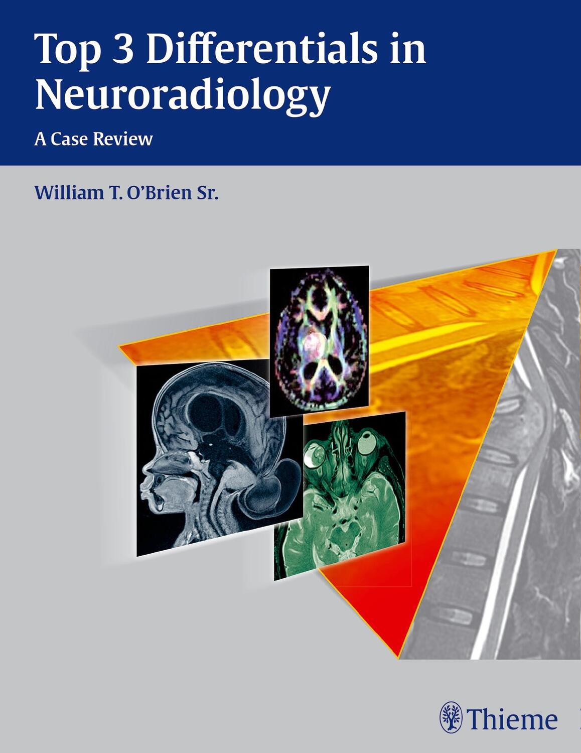 Cover: 9781604067231 | Top 3 Differentials in Neuroradiology | William T. O'Brien | Buch