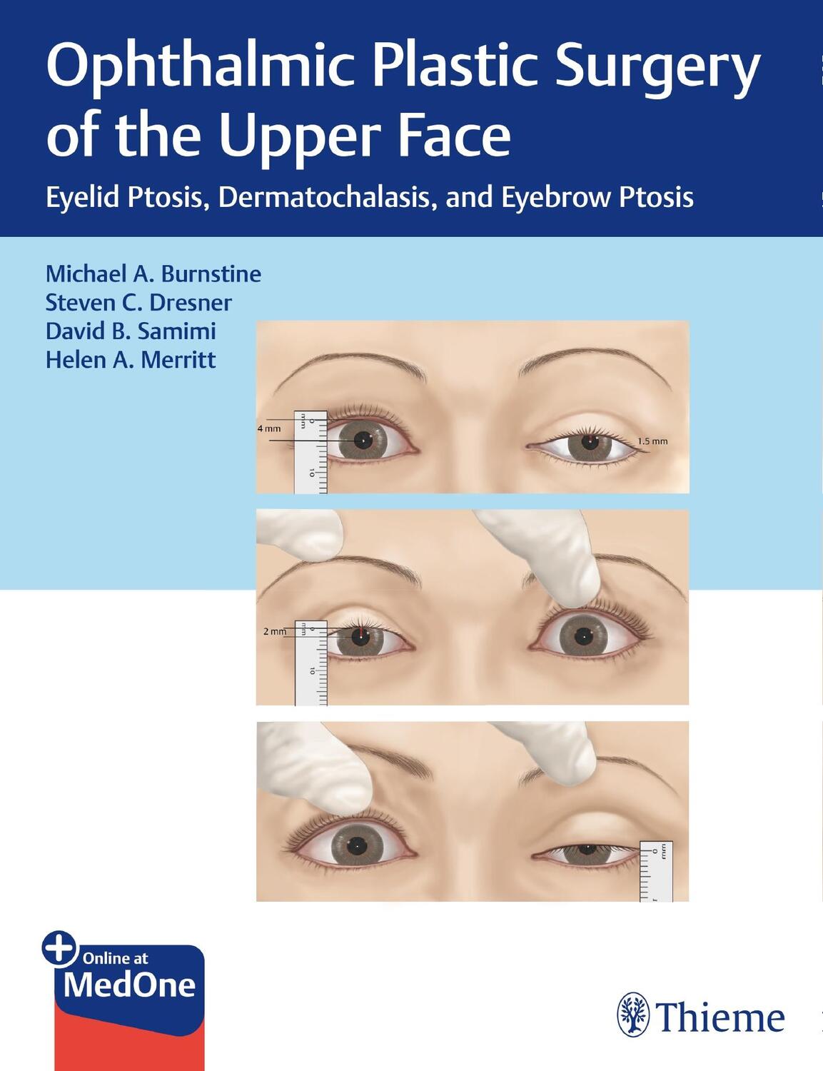 Cover: 9781626239210 | Ophthalmic Plastic Surgery of the Upper Face: Eyelid Ptosis,...