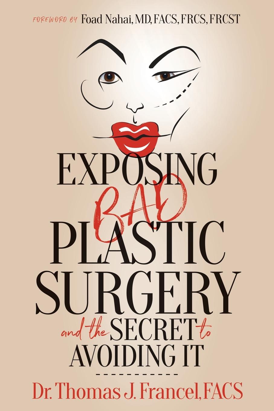 Cover: 9781636984346 | Exposing Bad Plastic Surgery | and the Secret to Avoiding It | Francel