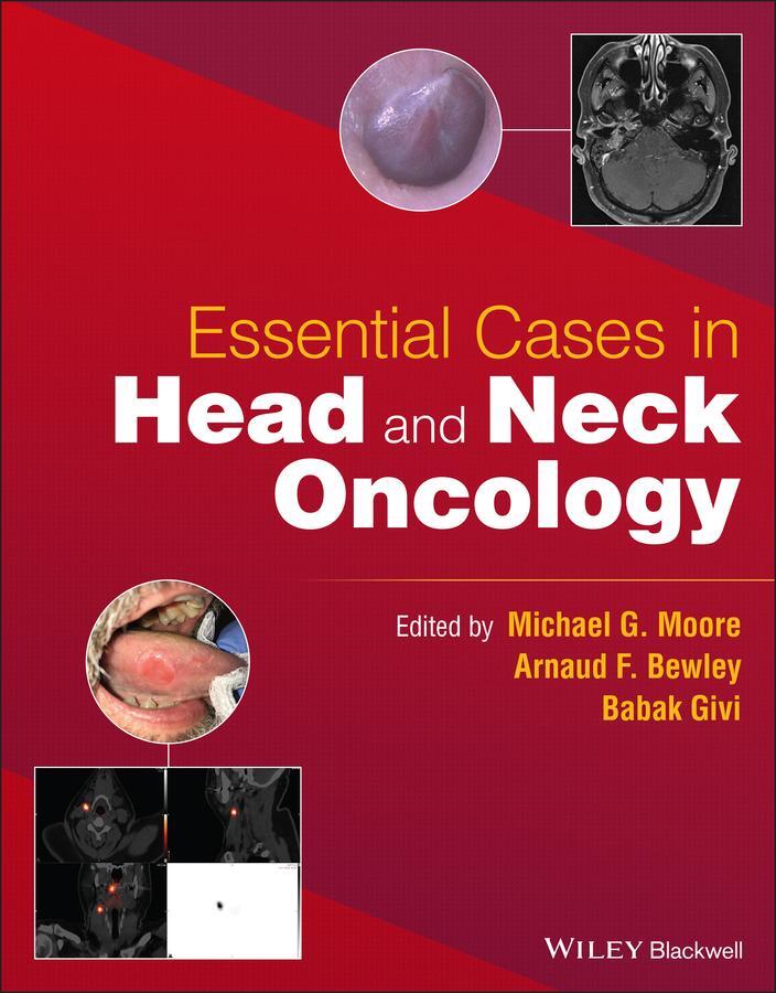 Cover: 9781119775942 | Essential Cases in Head and Neck Oncology | Michael G Moore (u. a.)