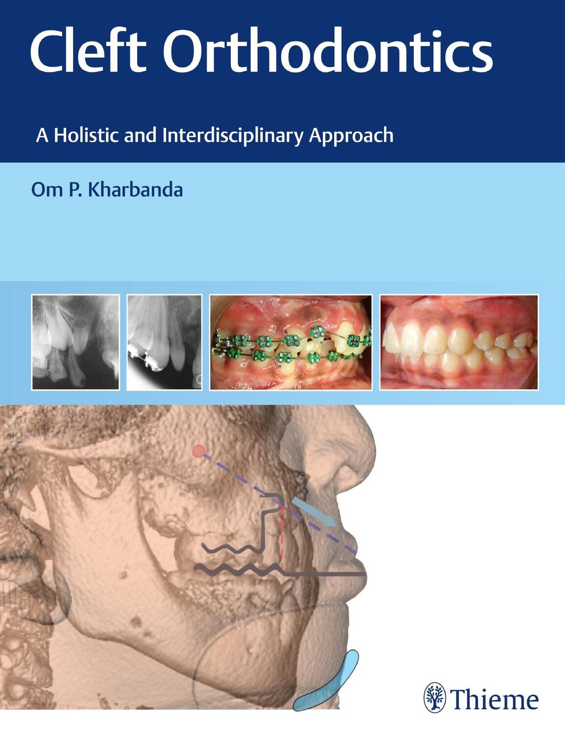Cover: 9788194857082 | Cleft Orthodontics | A Holistic and Interdisciplinary Approach | Buch