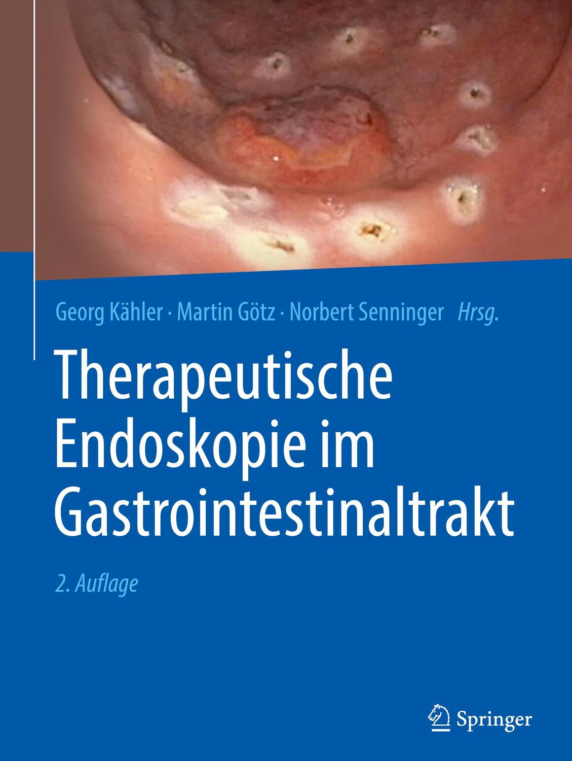 Cover: 9783662650868 | Therapeutische Endoskopie im Gastrointestinaltrakt | Kähler (u. a.)