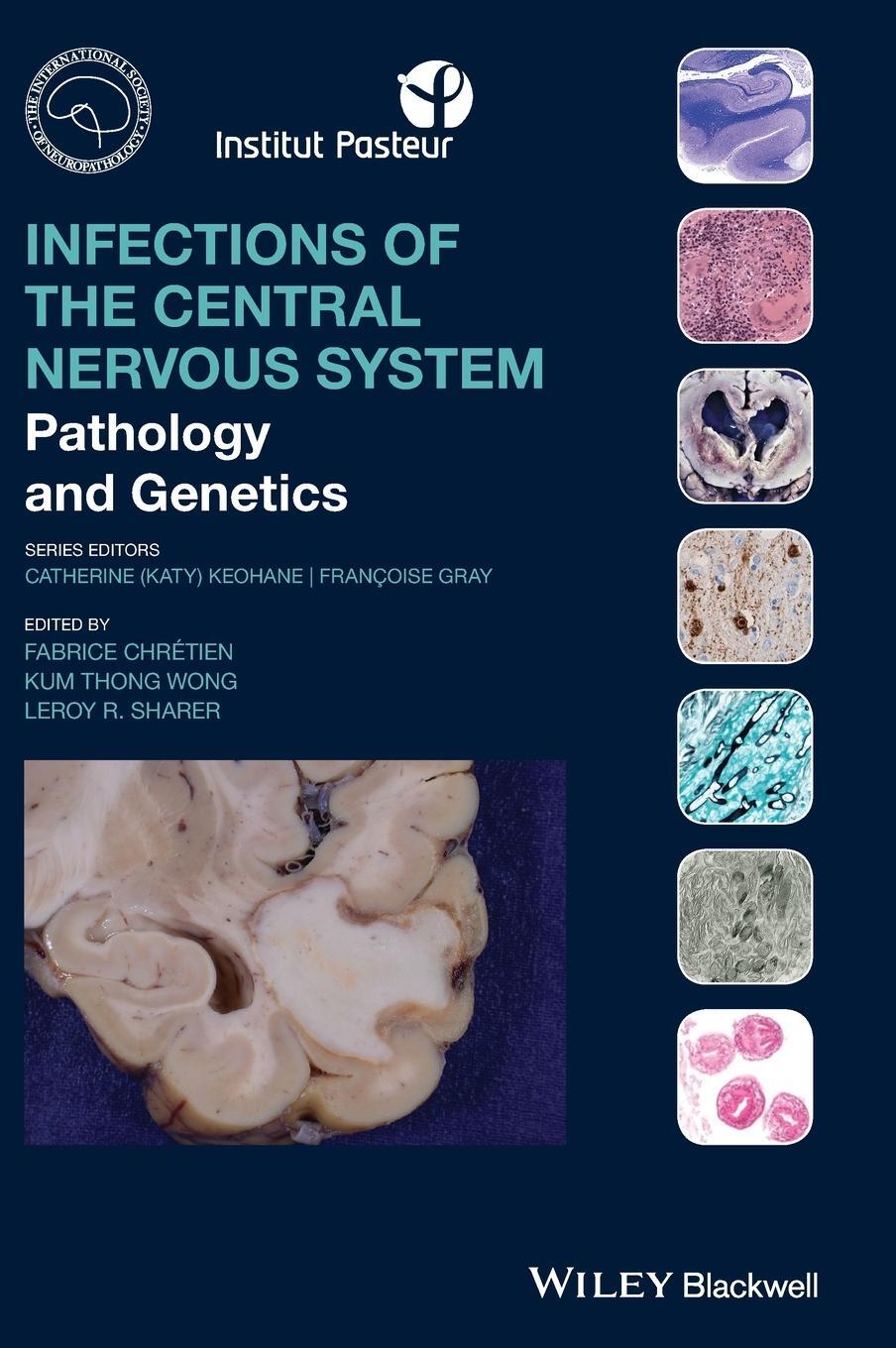 Cover: 9781119467762 | Infections of the Central Nervous System | Fabrice Chretien | Buch