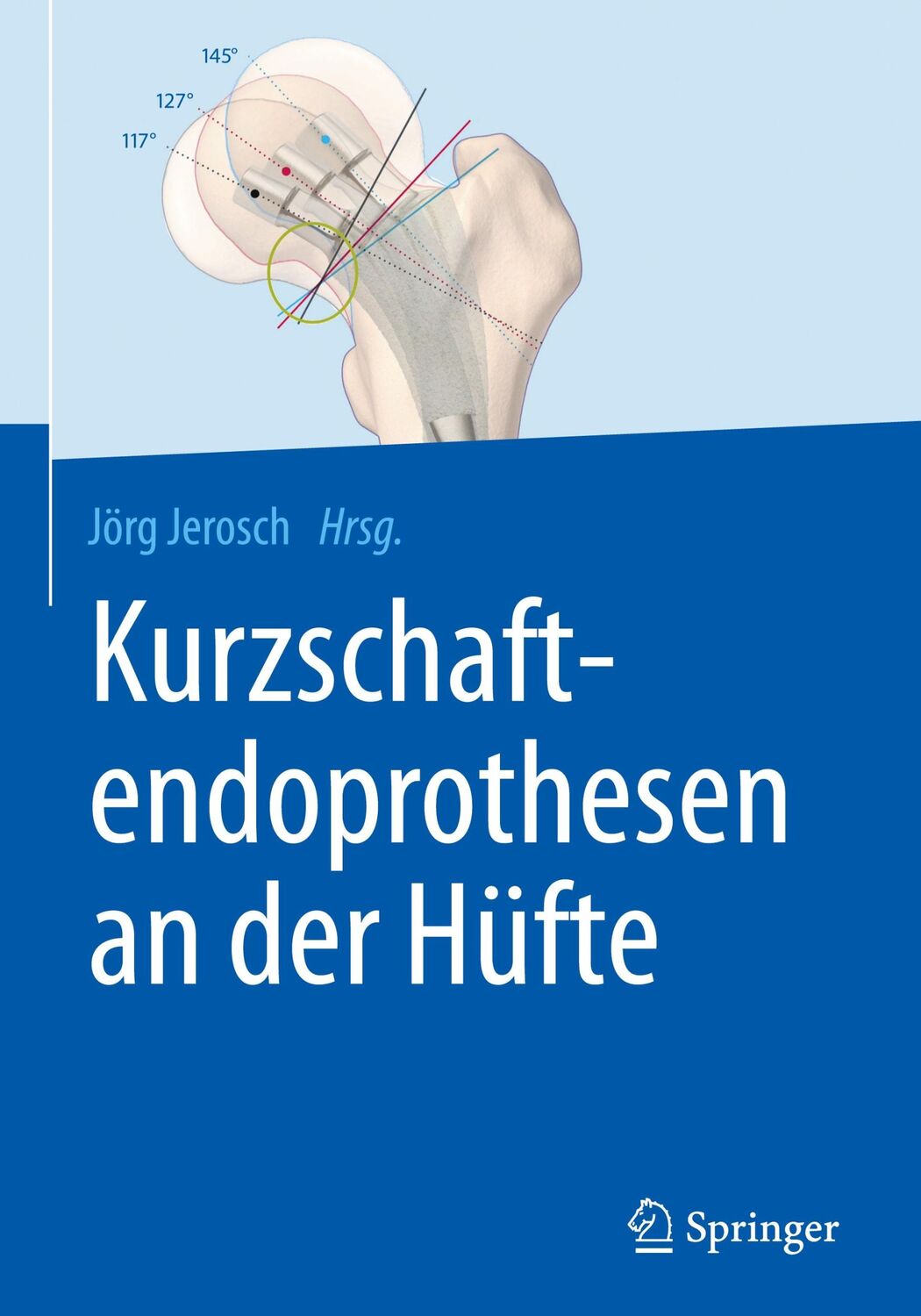 Cover: 9783662527436 | Kurzschaftendoprothesen an der Hüfte | Jörg Jerosch | Buch | xvi