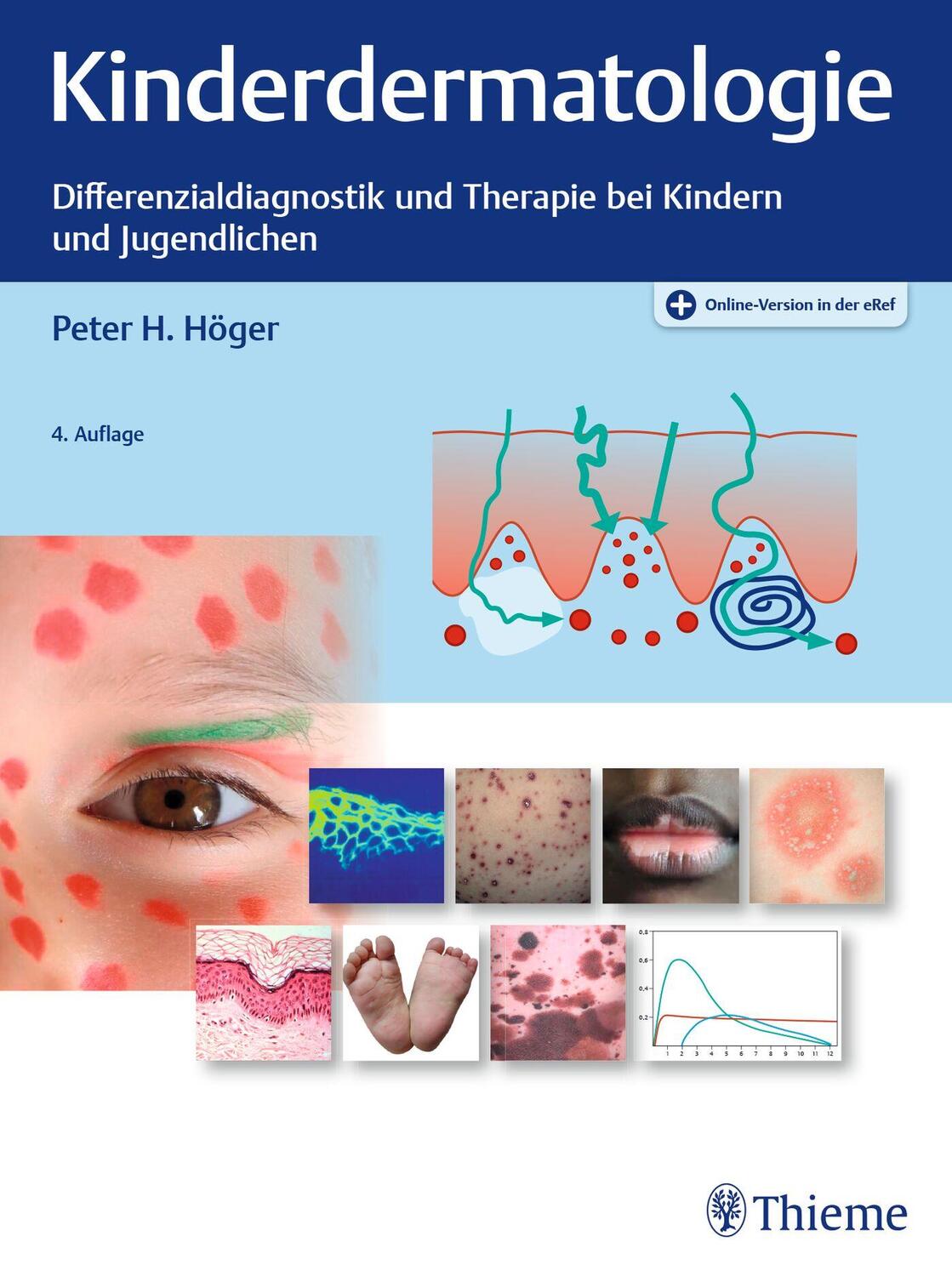 Cover: 9783132420649 | Kinderdermatologie | Peter H. Höger | Bundle | Mixed media product