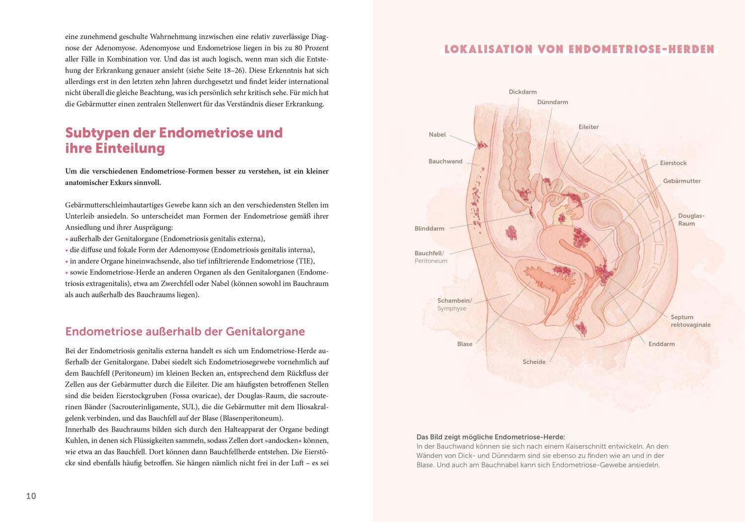 Bild: 9783965841611 | Endometriose - Die unterschätzte Krankheit | Sylvia Mechsner | Buch