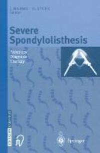 Cover: 9783642632853 | Severe Spondylolisthesis | Pathology - Diagnosis - Therapy | Buch | X
