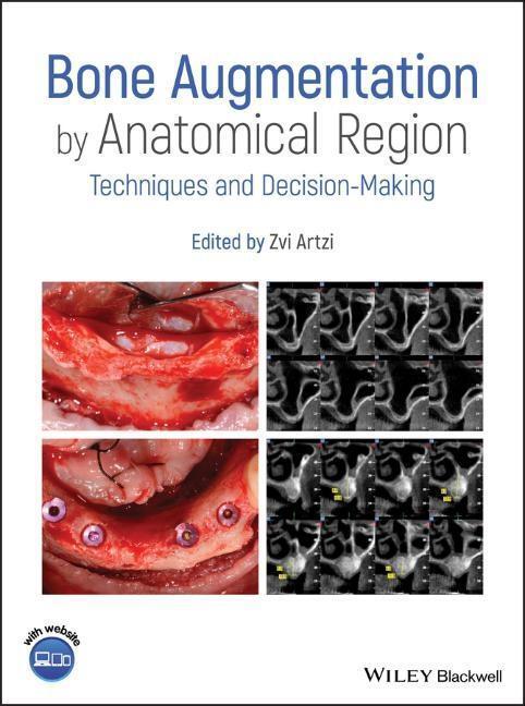 Cover: 9781119427841 | Bone Augmentation by Anatomical Region | Zvi Artzi | Buch | 560 S.