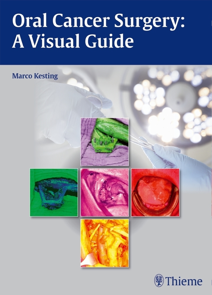 Cover: 9783131994011 | Oral Cancer Surgery | A Visual Guide | Marco Kesting | Buch | Englisch