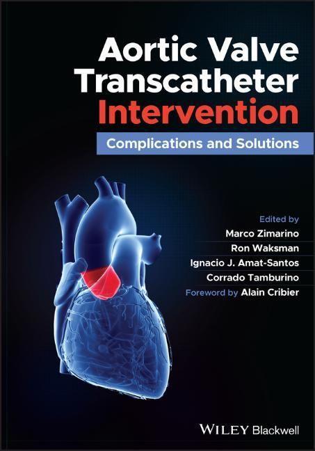 Cover: 9781119720591 | Aortic Valve Transcatheter Intervention | Complications and Solutions