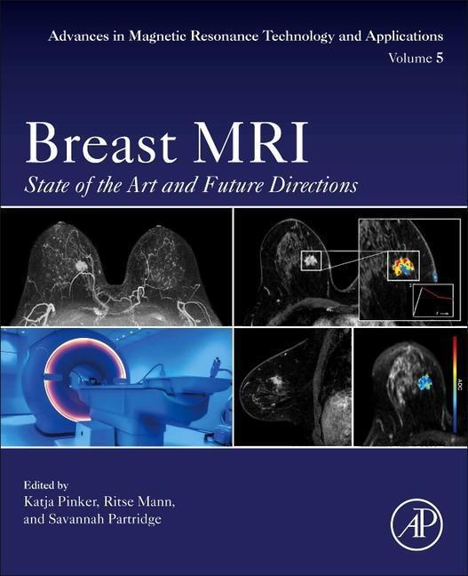 Cover: 9780128227299 | Breast MRI | State of the Art and Future Directions | Pinker (u. a.)