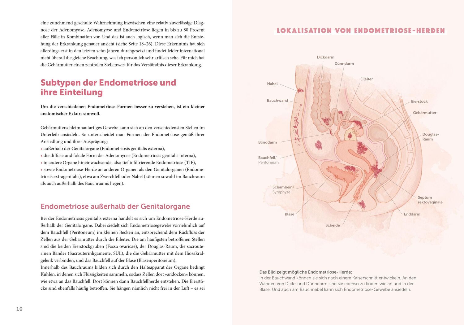 Bild: 9783965841611 | Endometriose - Die unterschätzte Krankheit | Sylvia Mechsner | Buch