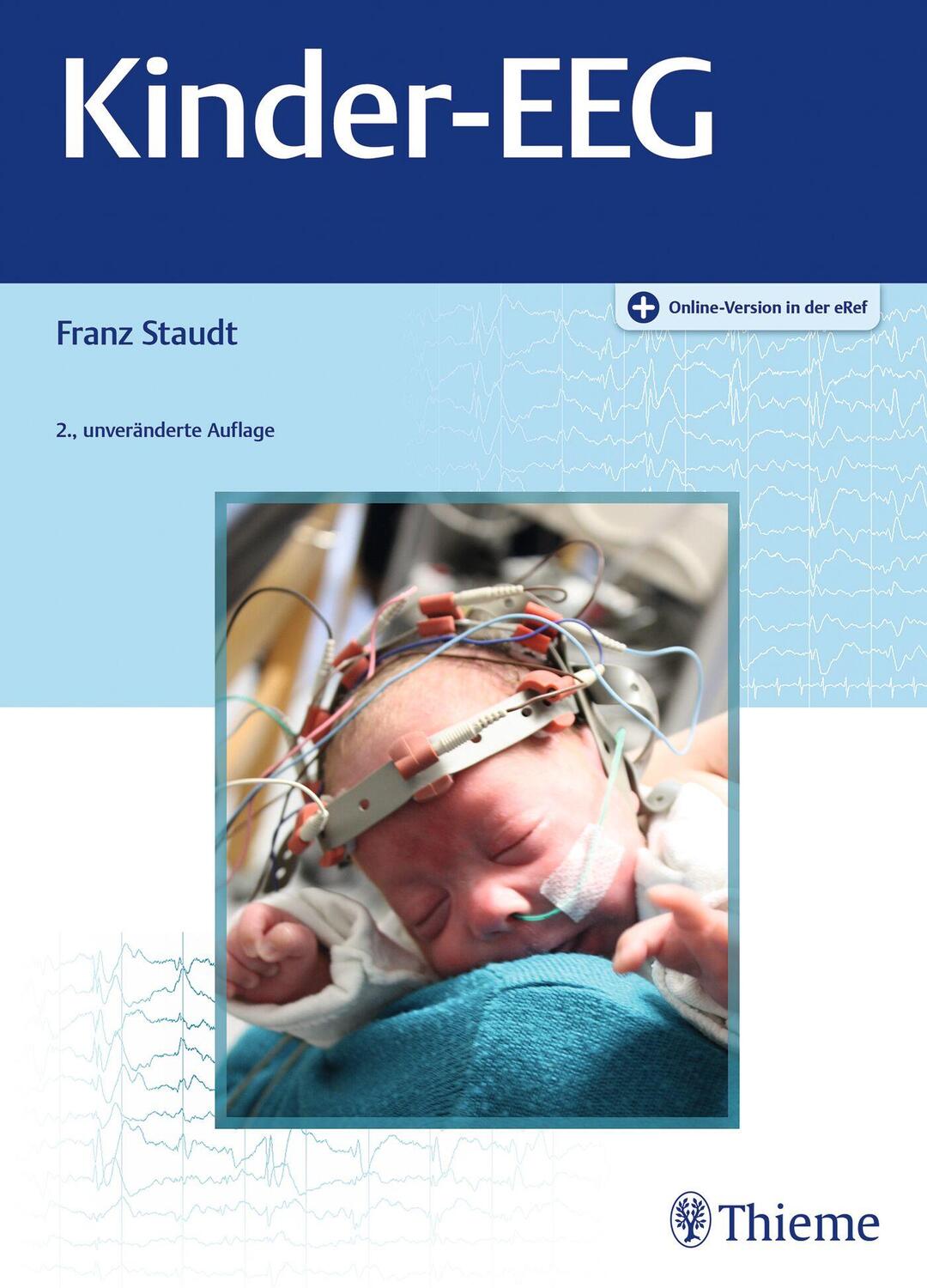 Cover: 9783132452497 | Kinder-EEG | Franz Staudt | Bundle | Mixed Media Product | 1 Buch