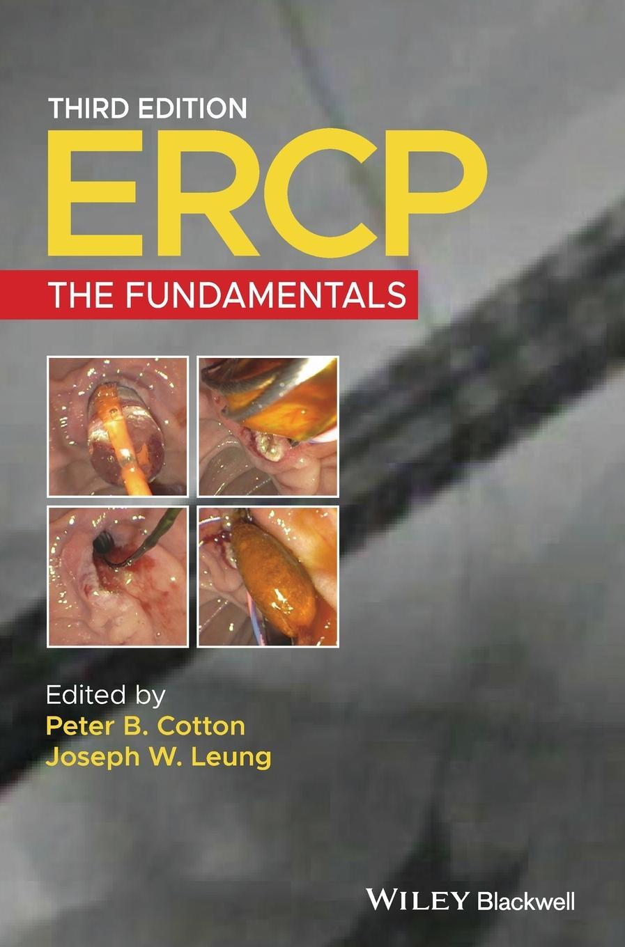 Cover: 9781119601098 | ERCP | Peter B. Cotton | Buch | HC gerader Rücken kaschiert | Englisch