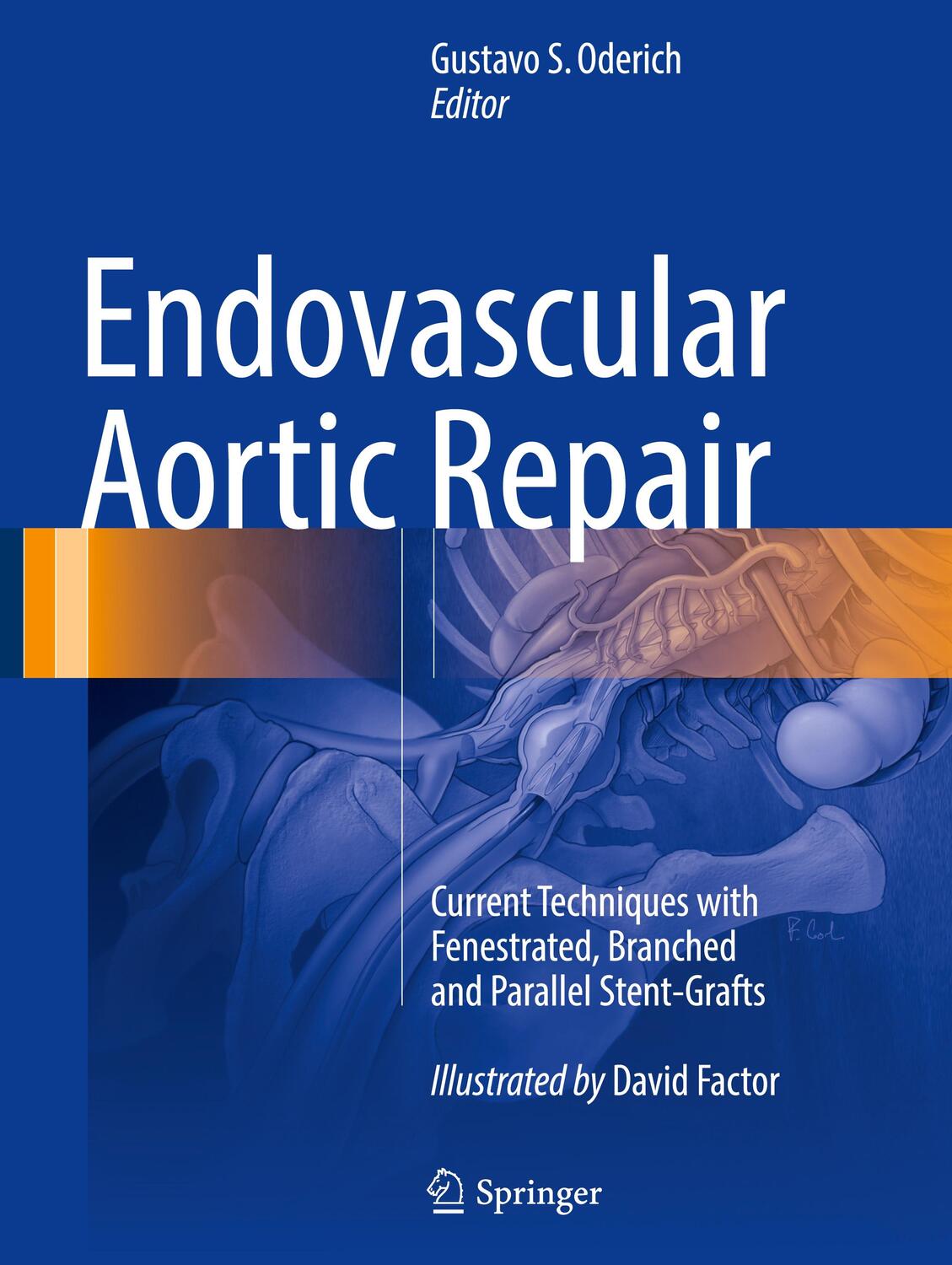 Cover: 9783319151915 | Endovascular Aortic Repair | Gustavo S. Oderich | Buch | Englisch