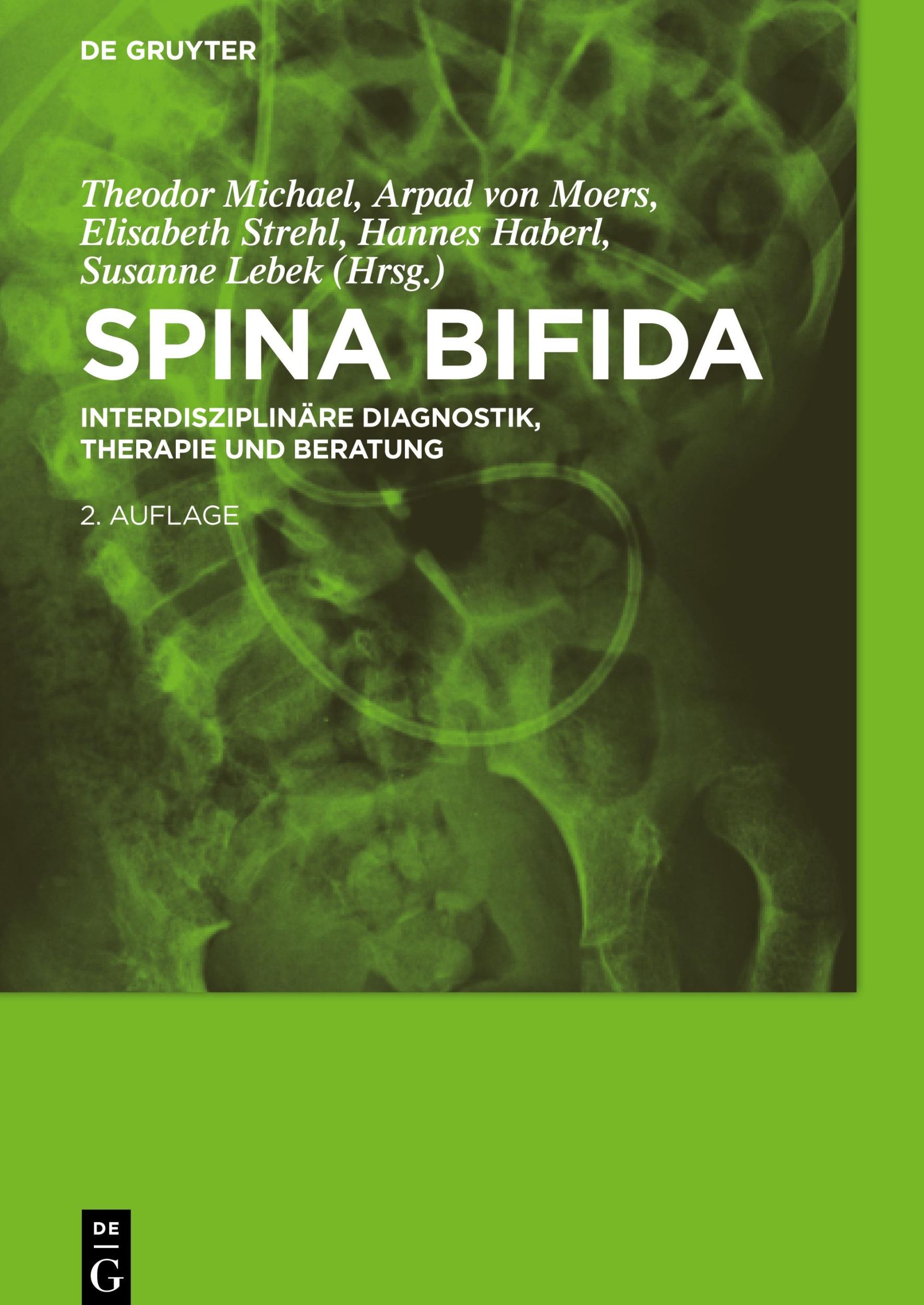 Cover: 9783110209532 | Spina bifida | Interdisziplinäre Diagnostik, Therapie und Beratung