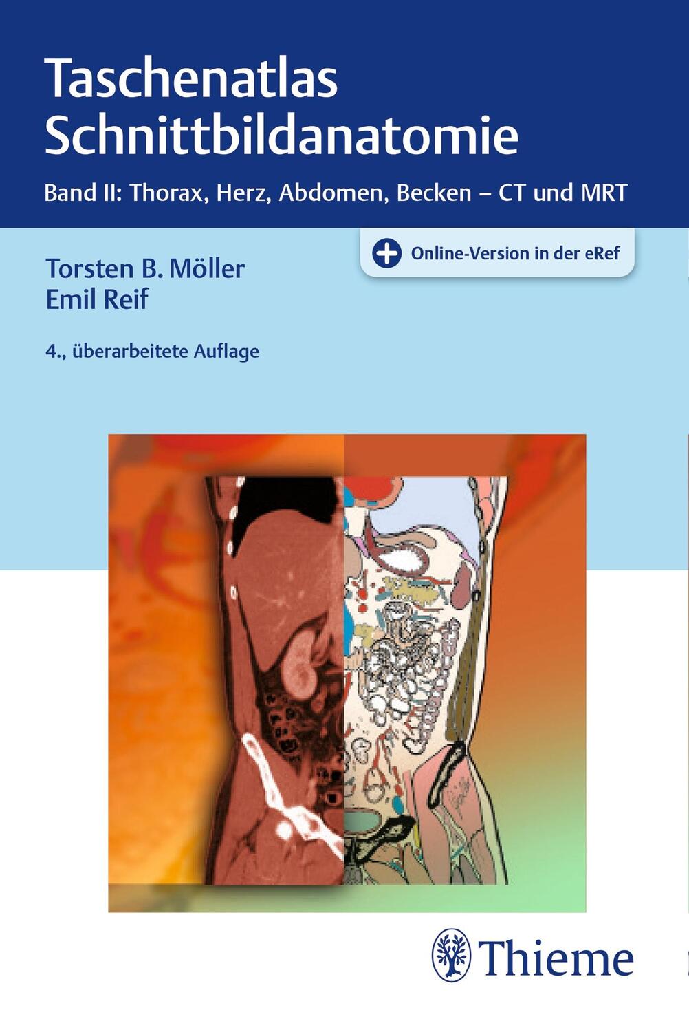 Cover: 9783131108043 | Taschenatlas Schnittbildanatomie 02 | Torsten Bert Möller (u. a.)
