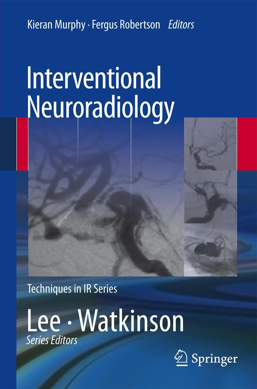 Cover: 9781447145813 | Interventional Neuroradiology | Kieran Murphy (u. a.) | Taschenbuch
