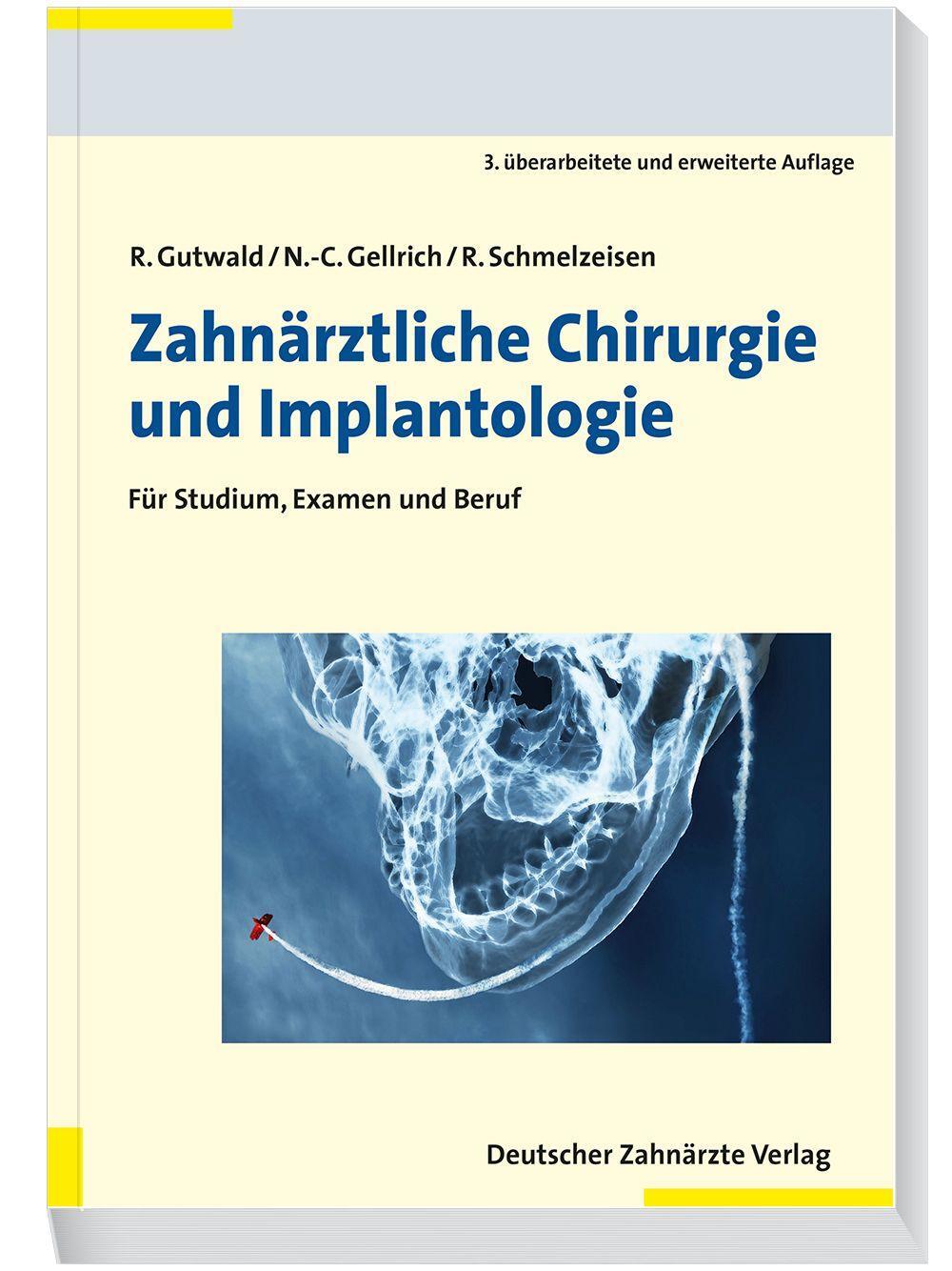 Cover: 9783769136579 | Zahnärztliche Chirurgie und Implantologie | Ralf Gutwald (u. a.)