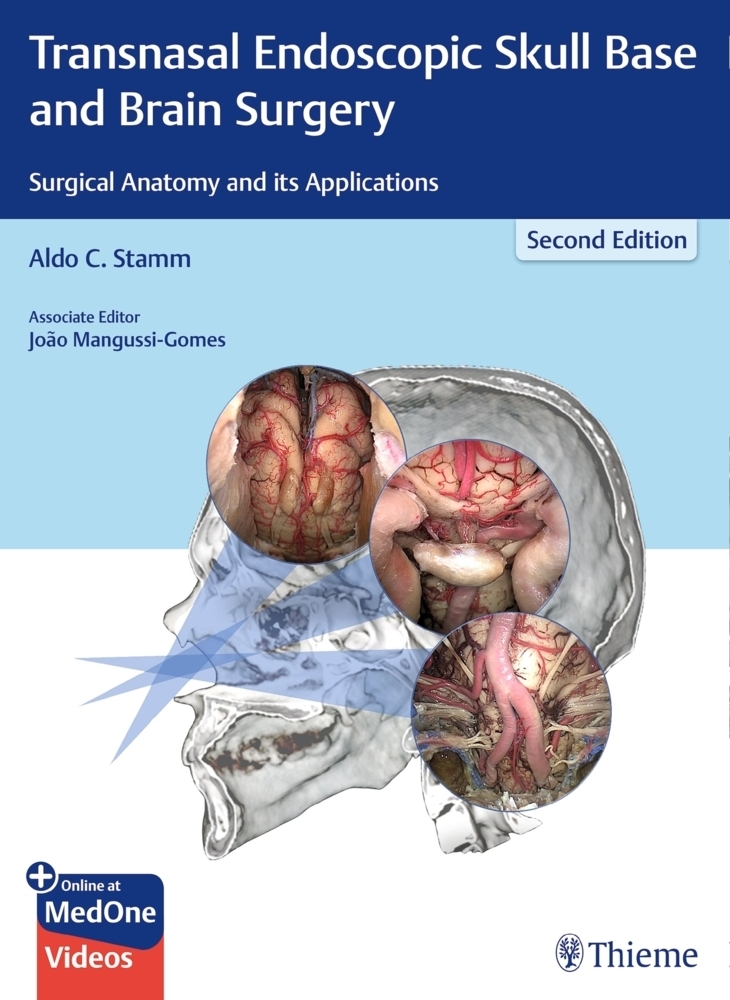 Cover: 9781626237100 | Transnasal Endoscopic Skull Base and Brain Surgery | Aldo C. Stamm