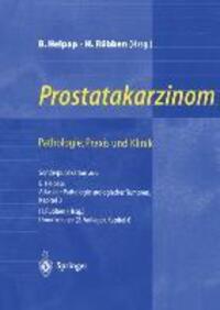 Cover: 9783540640066 | Prostatakarzinom ¿ Pathologie, Praxis und Klinik | Helpap (u. a.)