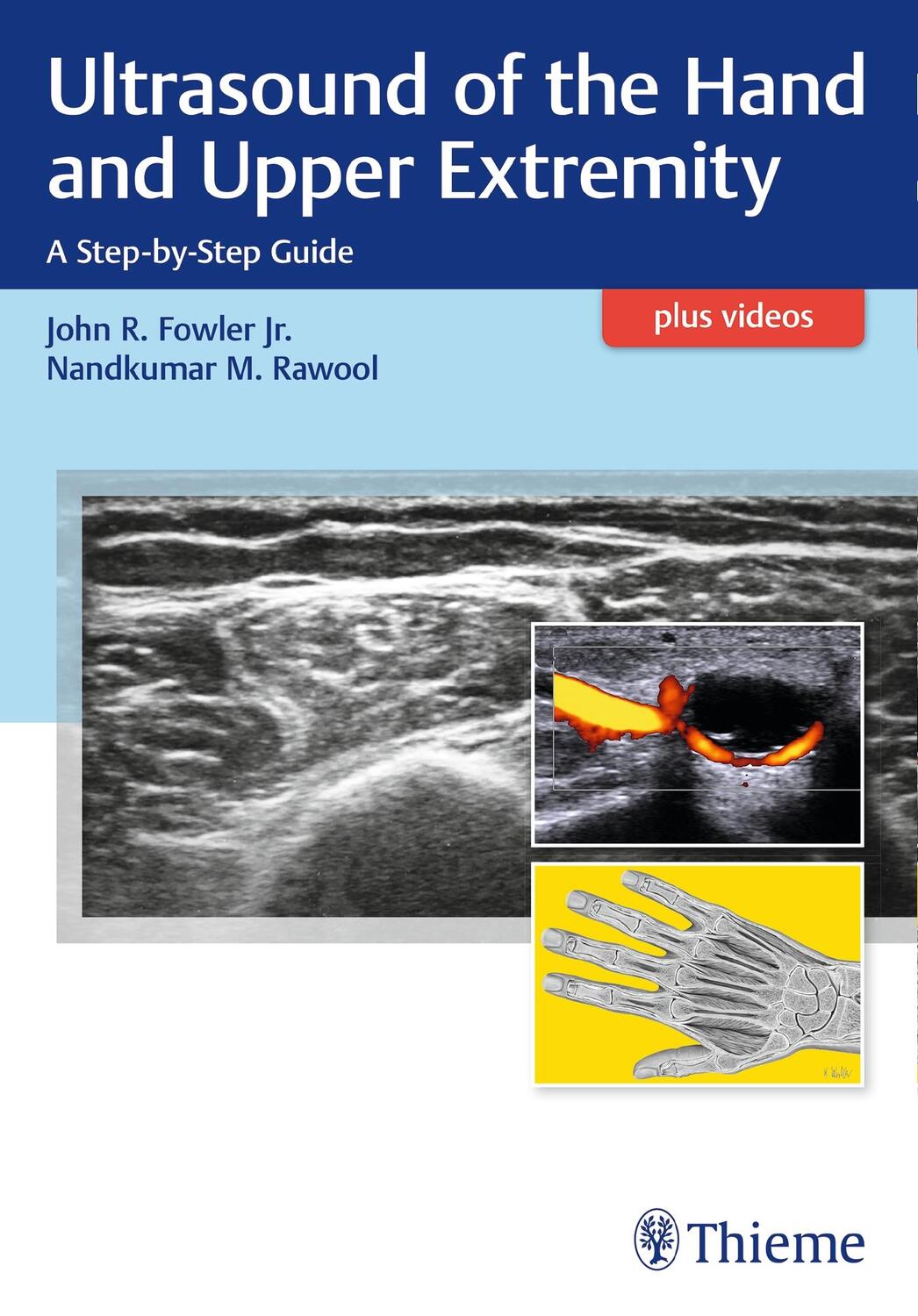 Cover: 9781626236882 | Ultrasound of the Hand and Upper Extremity | A Step-by-Step Guide