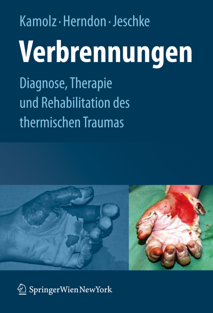 Cover: 9783211798959 | Verbrennungen | Lars-Peter Kamolz (u. a.) | Buch | 2009 | Springer
