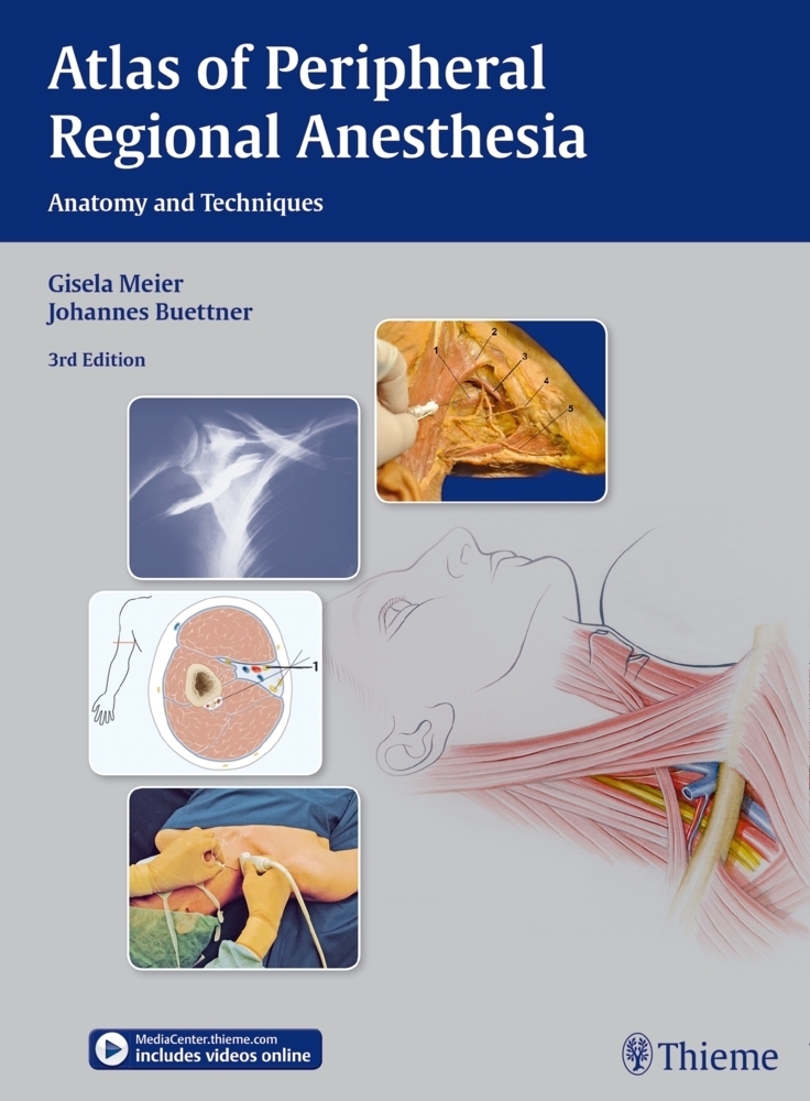 Cover: 9783131397935 | Atlas of Peripheral Regional Anesthesia | Gisela Meier (u. a.) | Buch