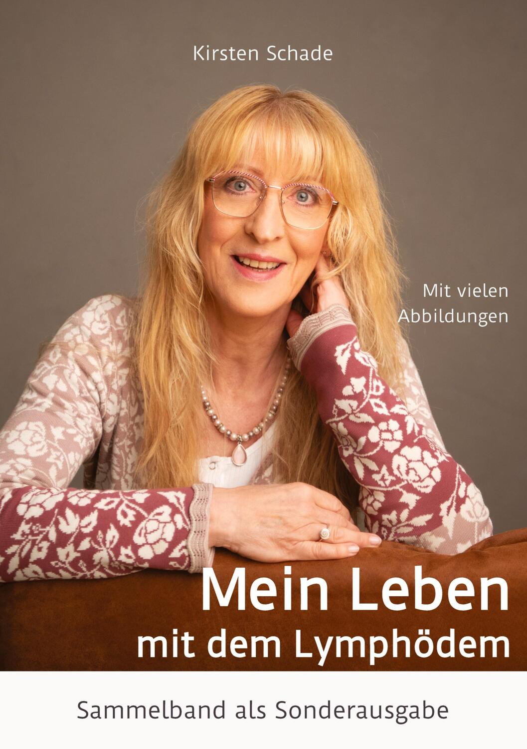 Cover: 9783384081124 | Mein Leben mit dem Lymphödem | Sammelband als Sonderausgabe | Schade