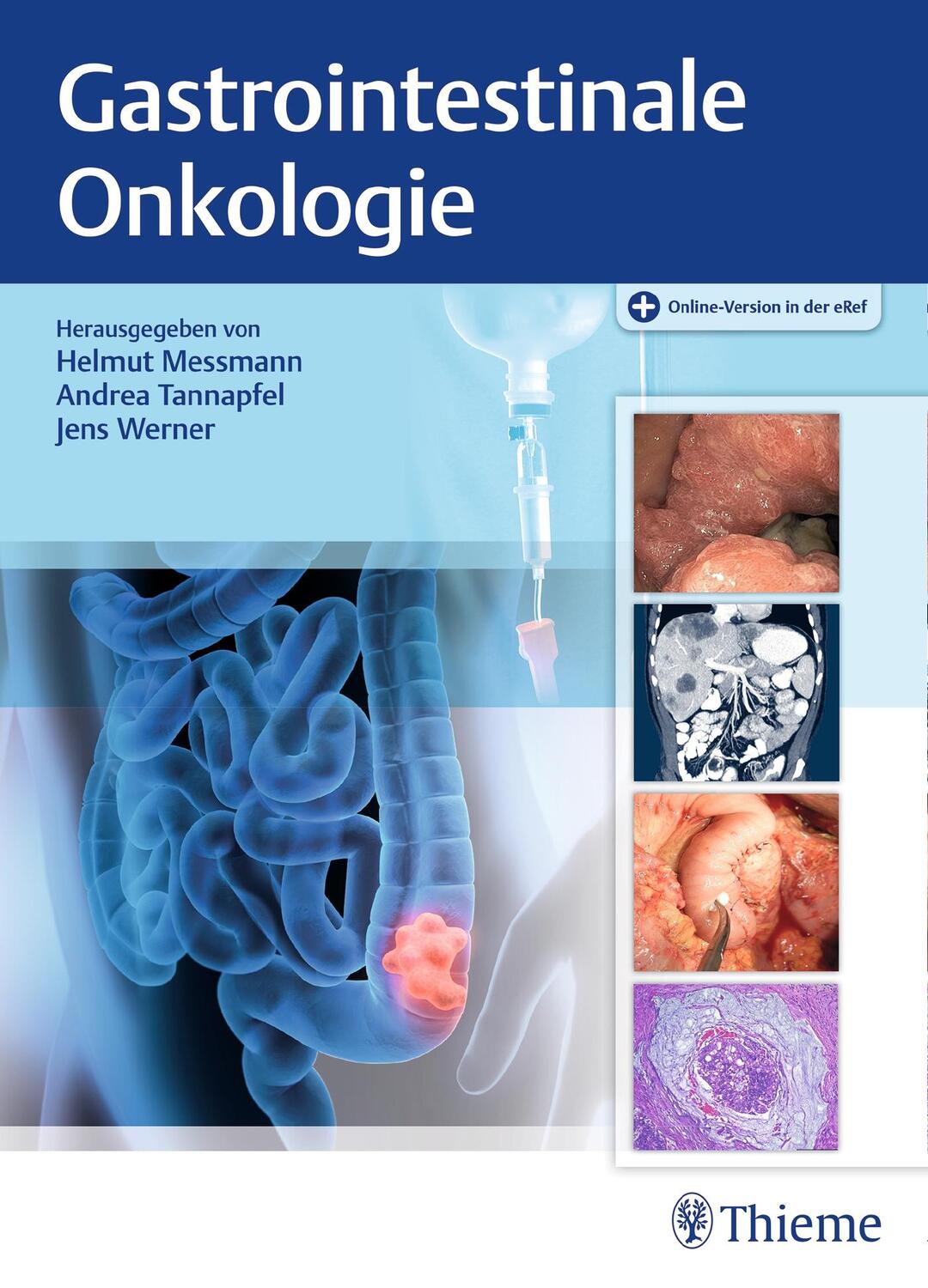 Cover: 9783131767615 | Gastrointestinale Onkologie | Helmut Messmann (u. a.) | Bundle | 2018