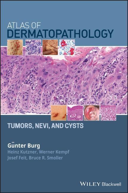 Cover: 9781119371540 | Atlas of Dermatopathology | Tumors, Nevi, and Cysts | Burg (u. a.)