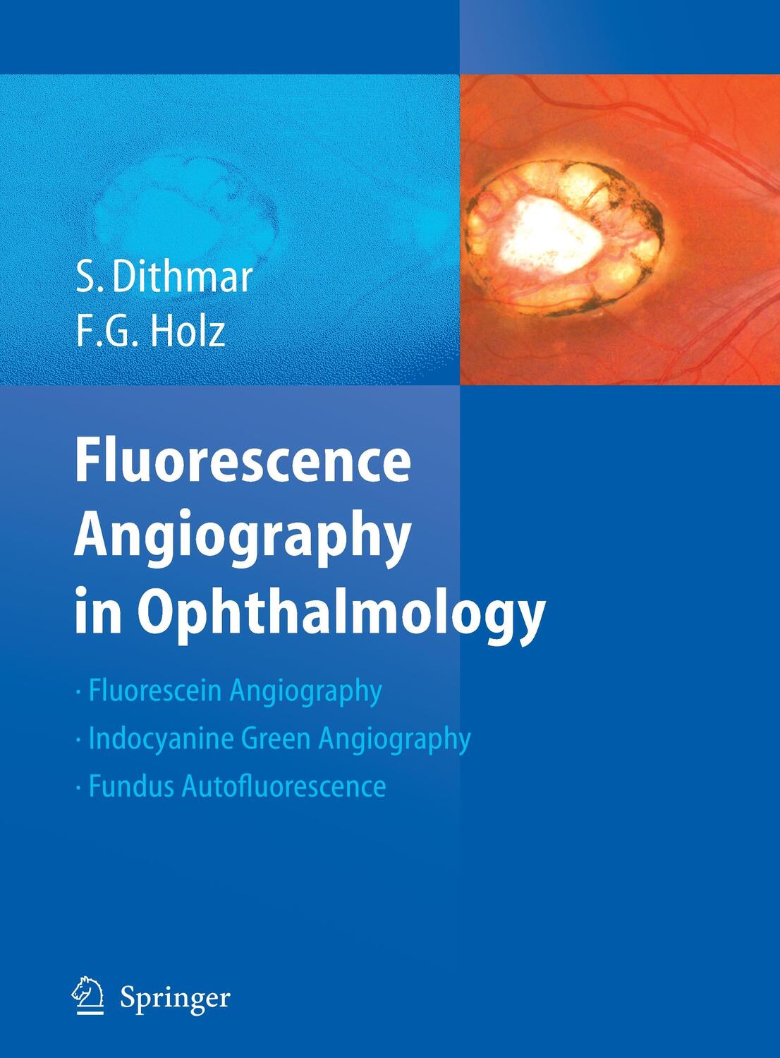 Cover: 9783540783596 | Fluorescence Angiography in Ophthalmology | Stefan Dithmar (u. a.)