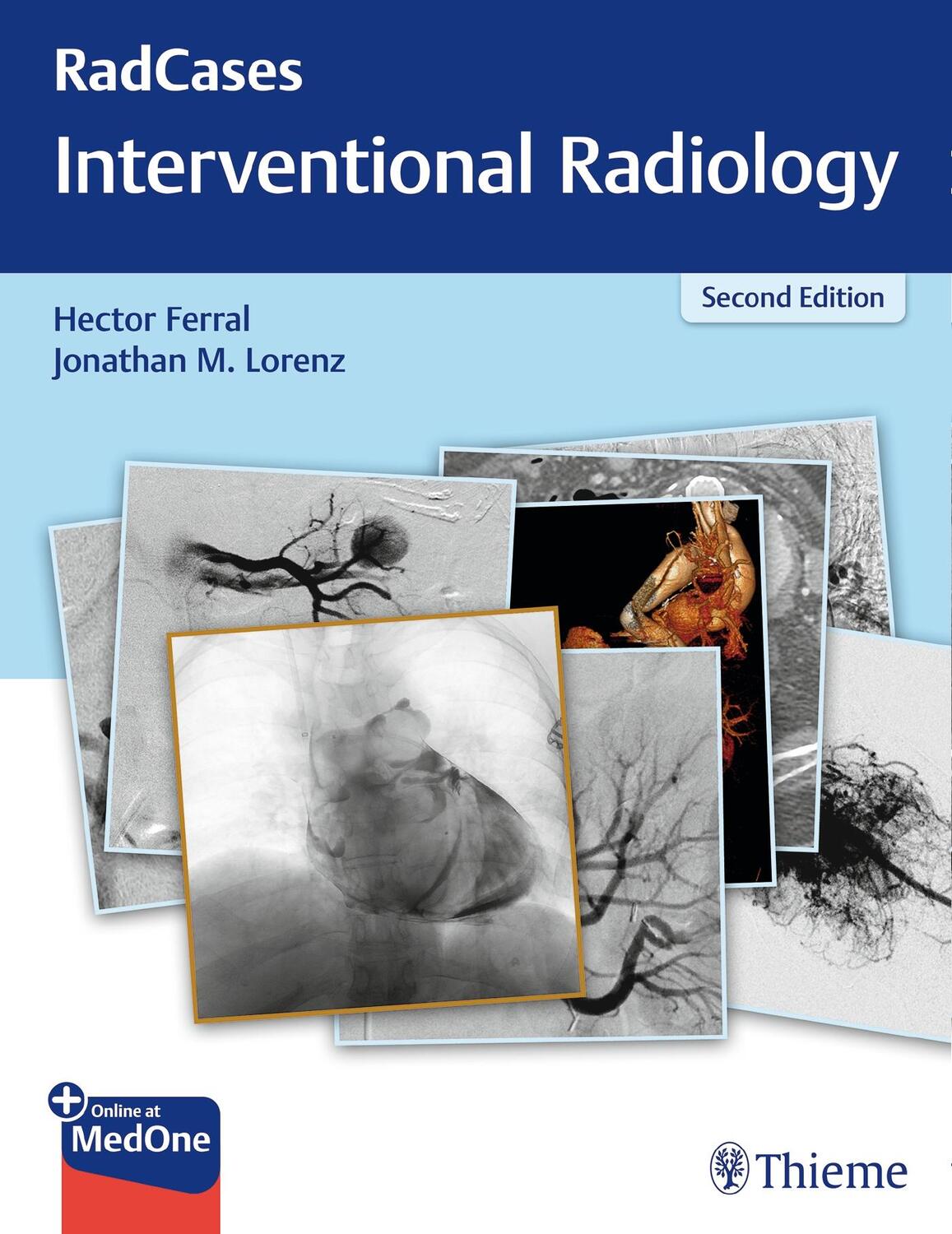 Cover: 9781626232822 | Radcases Q&amp;A Interventional Radiology | Hector Ferral (u. a.) | Buch