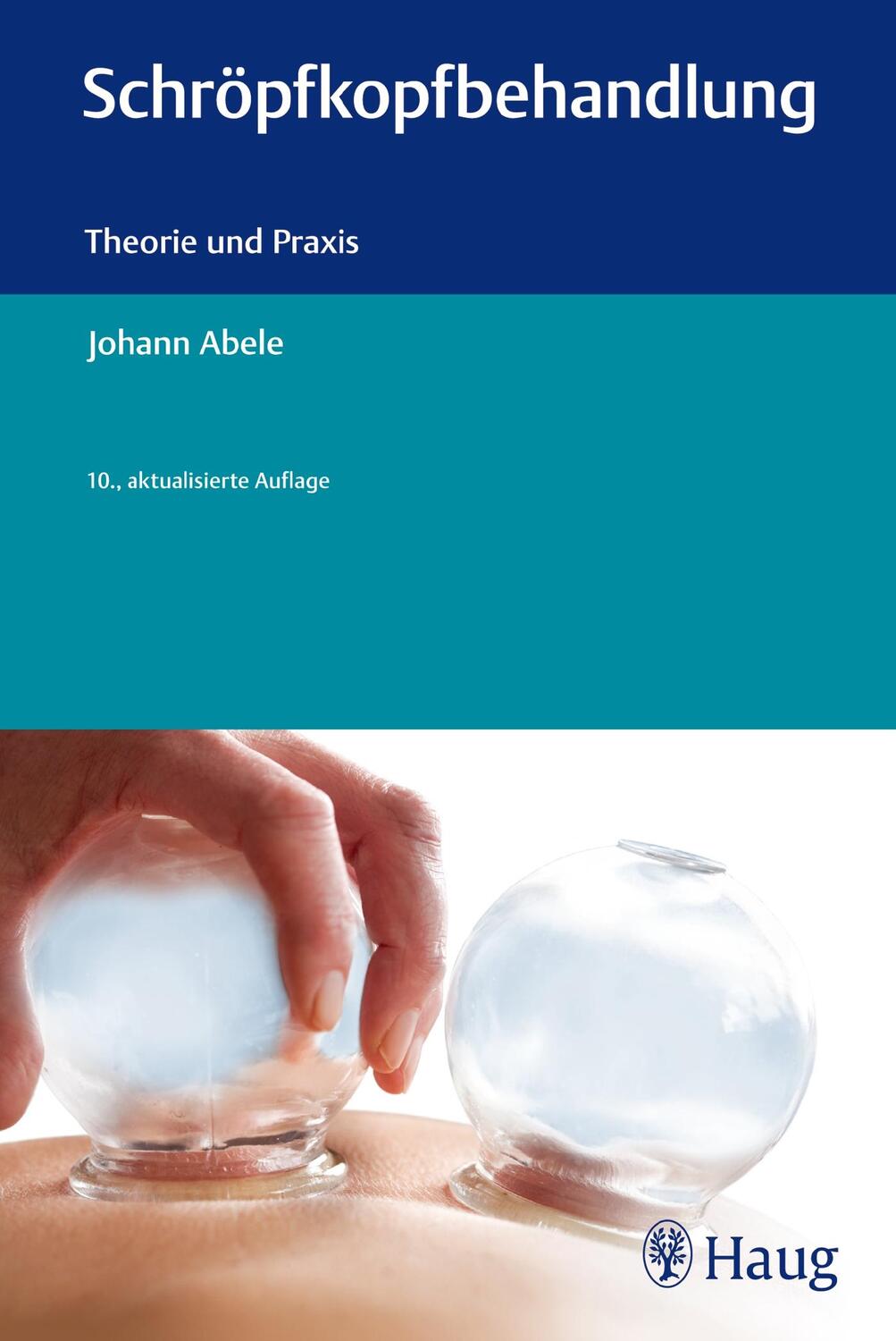 Cover: 9783830476832 | Schröpfkopfbehandlung | Theorie und Praxis | Johann Abele | Buch