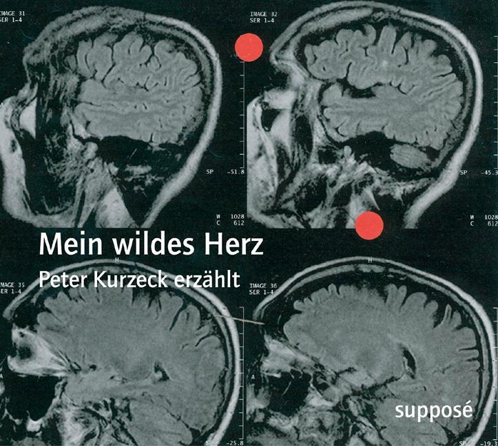 Cover: 9783932513985 | Mein wildes Herz | Peter Kurzeck erzählt | Peter Kurzeck (u. a.) | CD