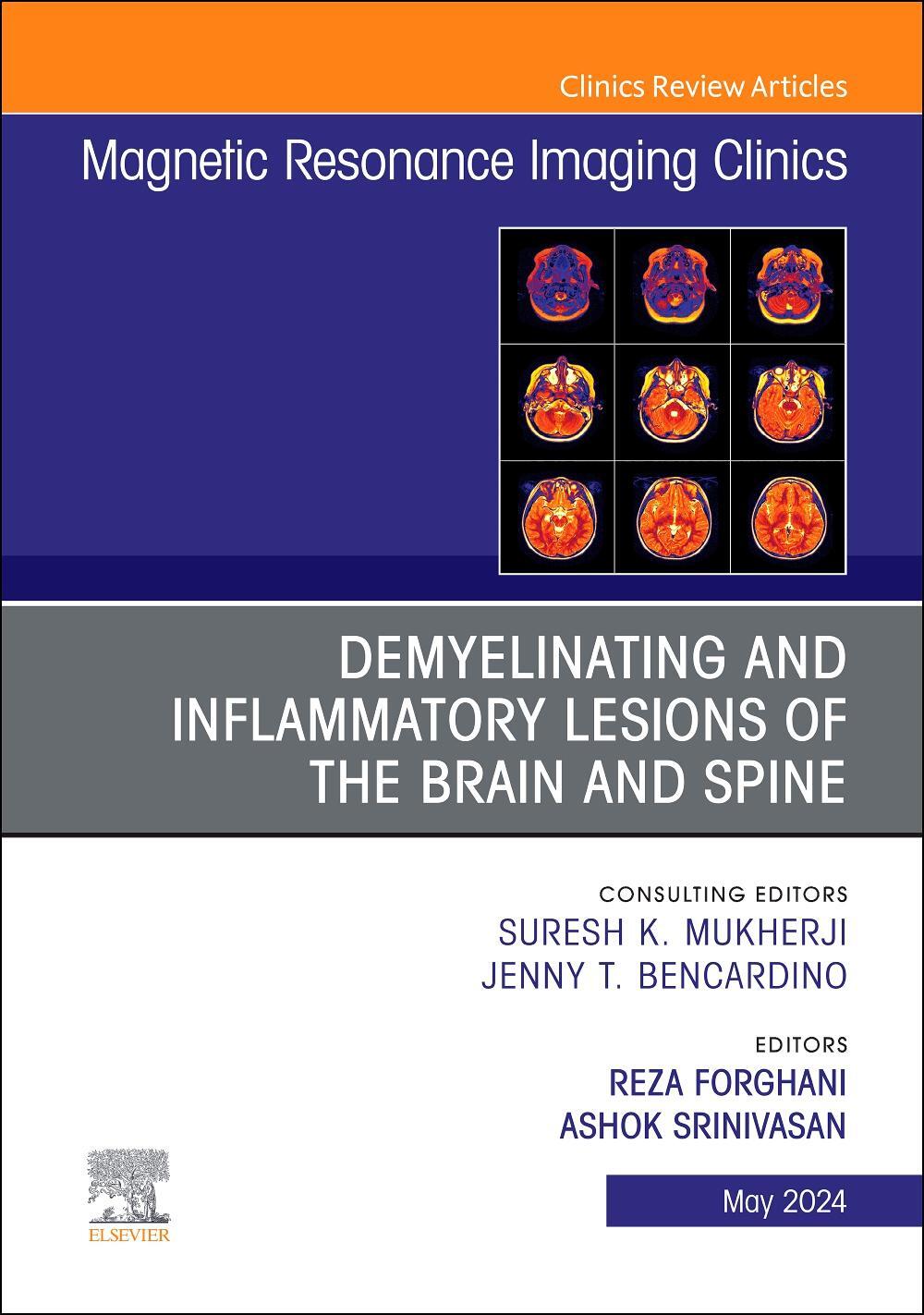 Cover: 9780443131691 | Demyelinating and Inflammatory Lesions of the Brain and Spine, an...