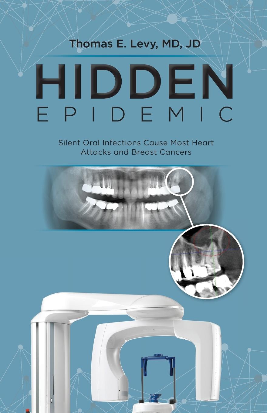 Cover: 9780983772873 | Hidden Epidemic | Md Jd Levy | Taschenbuch | Kartoniert / Broschiert