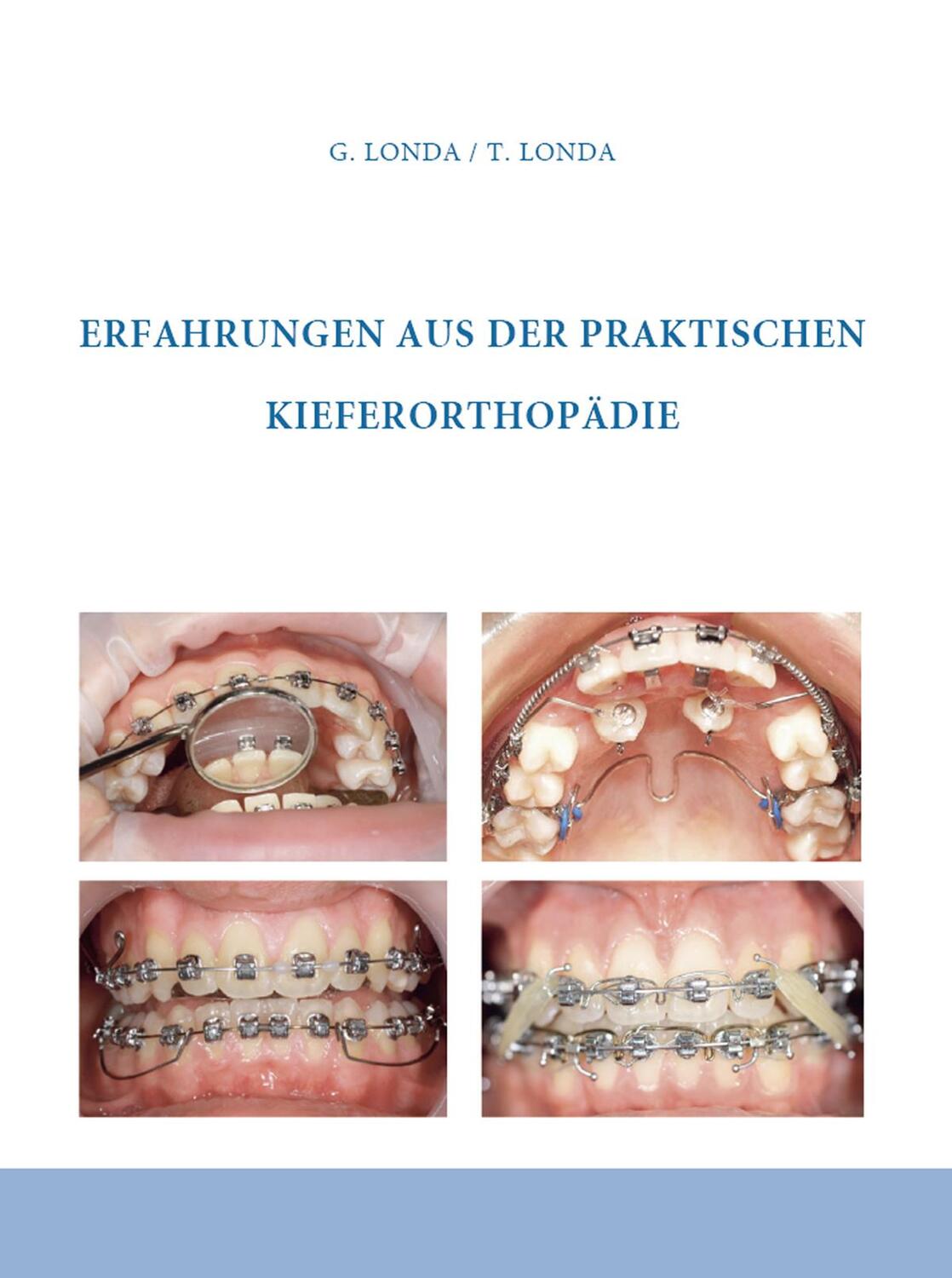 Cover: 9783863865290 | Erfahrungen aus der praktischen Kieferorthopädie | Londa (u. a.)