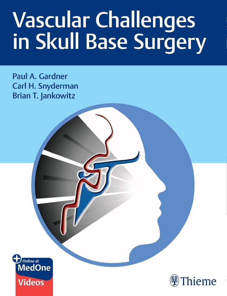 Cover: 9781684200689 | Vascular Challenges in Skull Base Surgery | Paul Gardner (u. a.)