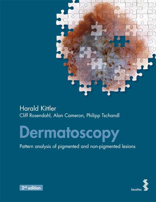 Cover: 9783708913858 | Dermatoscopy | An algorithmic method based on pattern analysis | Buch
