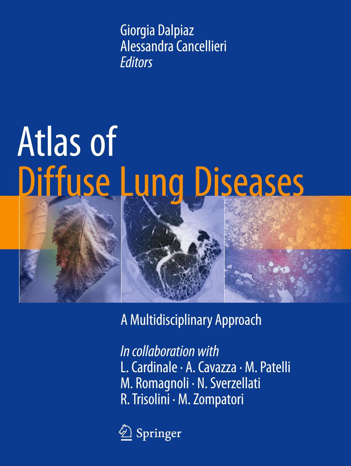 Cover: 9783319826547 | Atlas of Diffuse Lung Diseases | A Multidisciplinary Approach | Buch