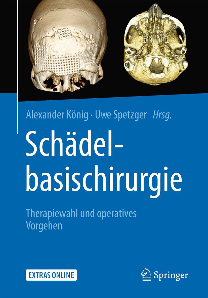 Cover: 9783662546710 | Schädelbasischirurgie | Therapiewahl und operatives Vorgehen | Buch