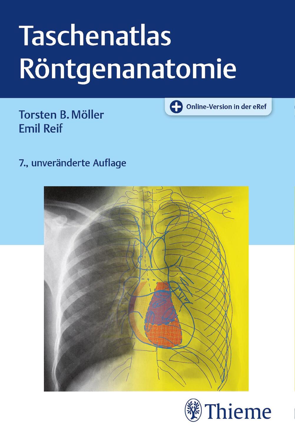 Cover: 9783132441873 | Taschenatlas Röntgenanatomie | Torsten Bert Möller (u. a.) | Bundle