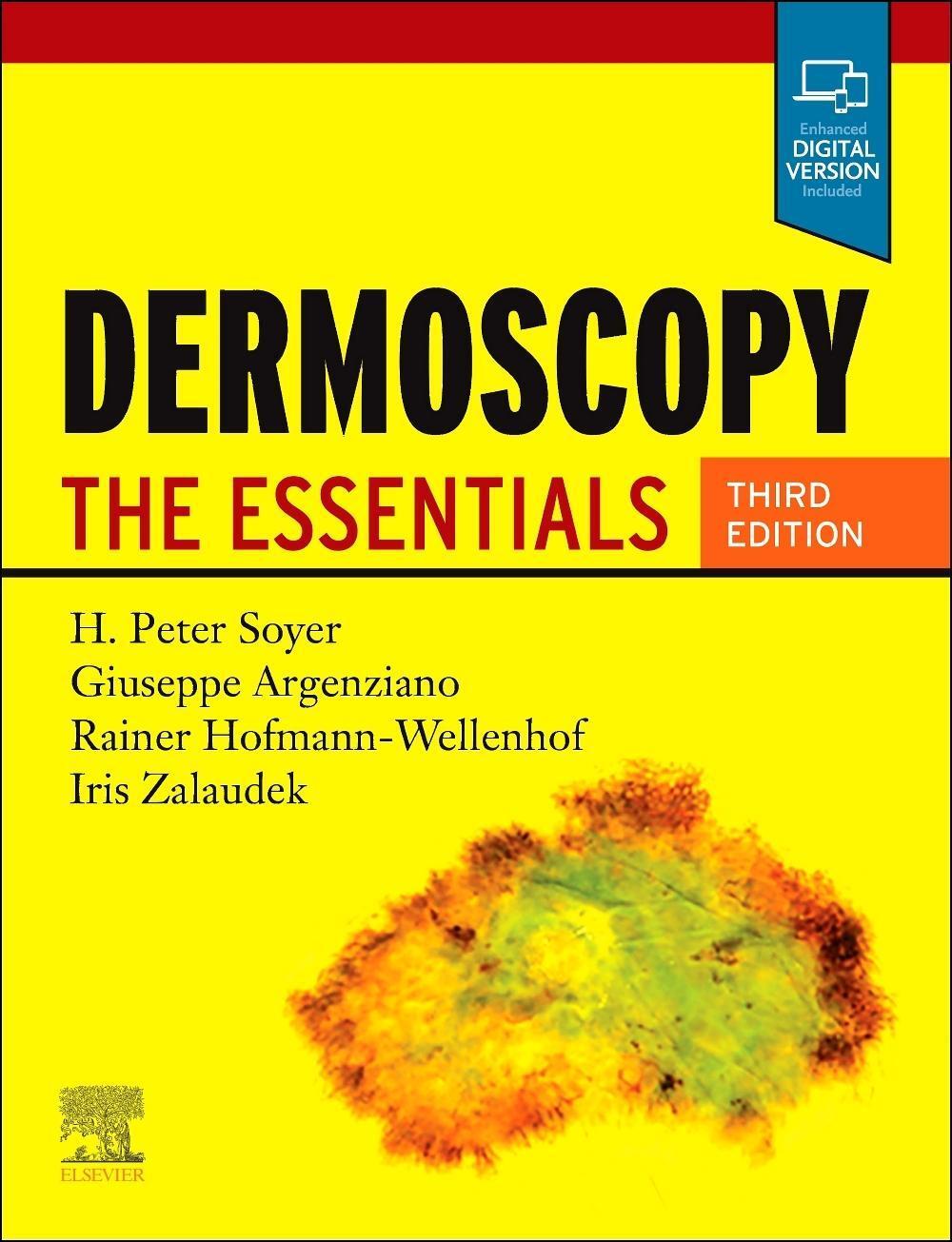 Cover: 9780702068829 | Dermoscopy | The Essentials | H Peter Soyer (u. a.) | Taschenbuch