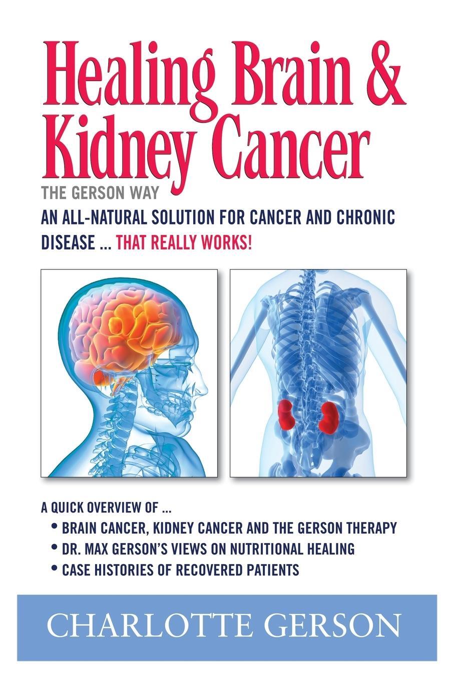 Cover: 9781937920012 | Healing Brain and Kidney Cancer - The Gerson Way | Charlotte Gerson