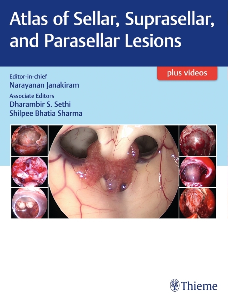 Cover: 9789388257534 | Atlas of Sellar, Suprasellar, and Parasellar Lesions | Janakiram