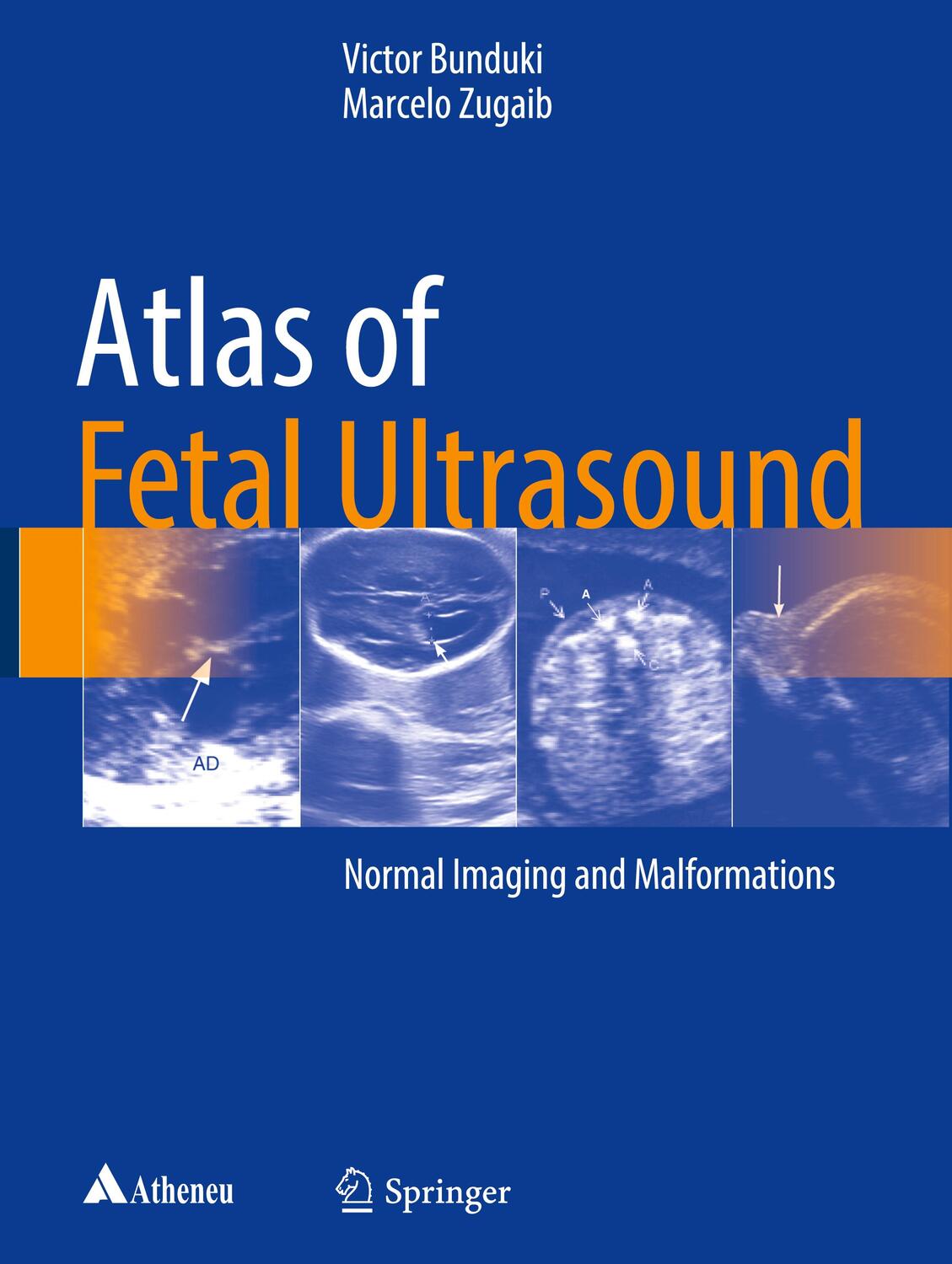Cover: 9783319547978 | Atlas of Fetal Ultrasound | Normal Imaging and Malformations | Buch