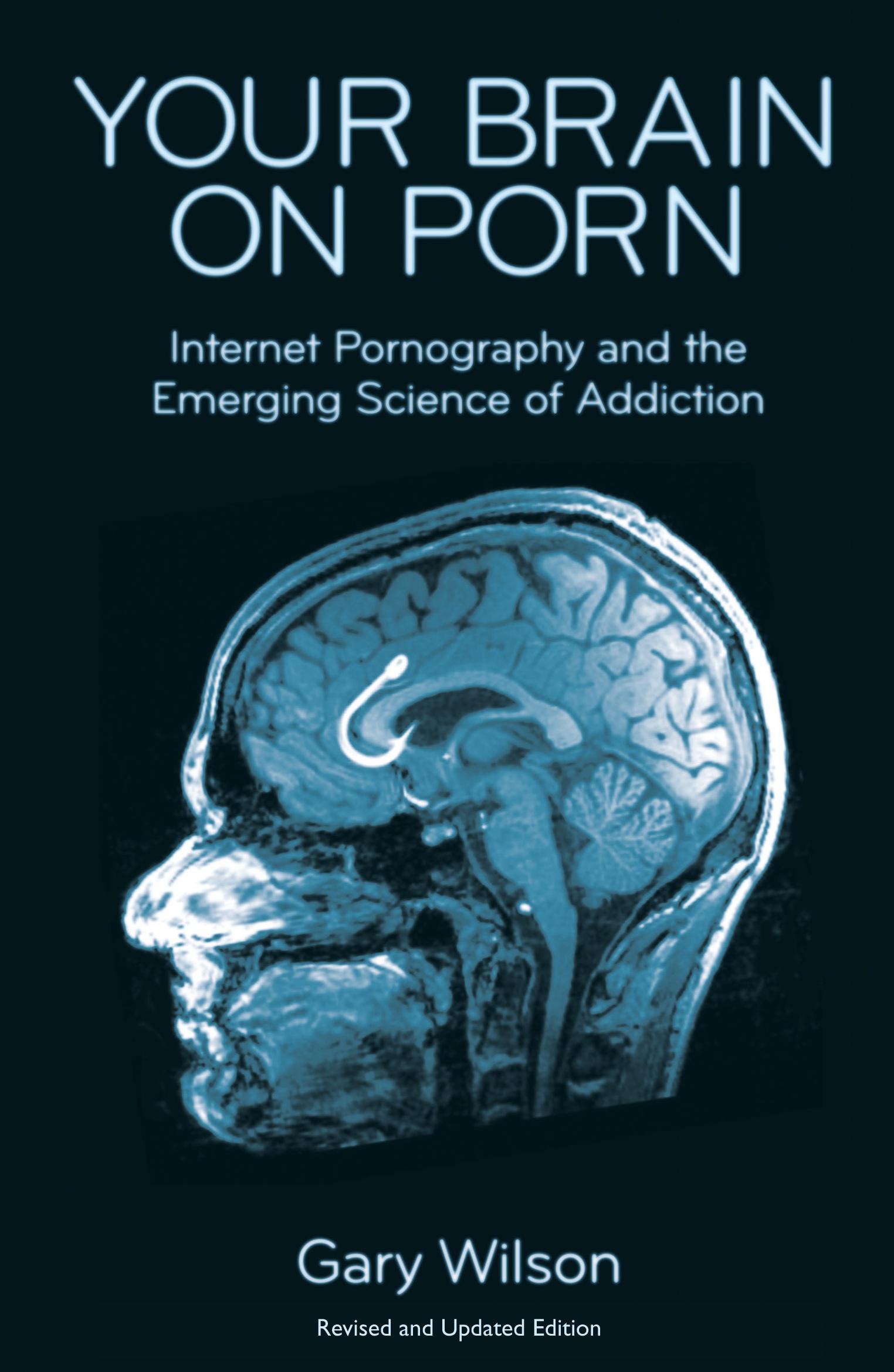 Cover: 9780993161605 | Your Brain on Porn | Gary Wilson | Taschenbuch | Englisch | 2015