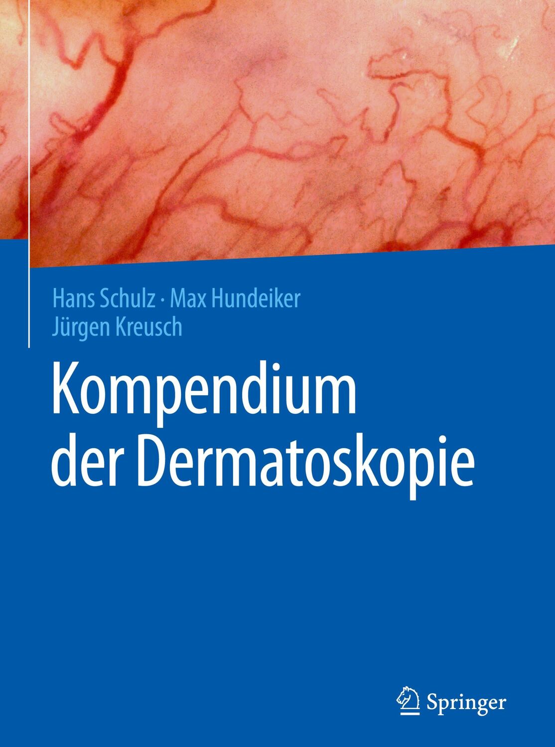 Cover: 9783662494905 | Kompendium der Dermatoskopie | Hans Schulz (u. a.) | Buch | xi | 2016