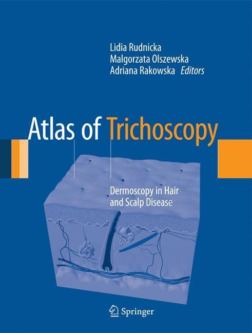 Cover: 9781447144854 | Atlas of Trichoscopy | Dermoscopy in Hair and Scalp Disease | Buch